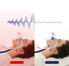 BreatheEasy – Micro CPAP Reisapparaat tegen Snurken en Slaapapneu
